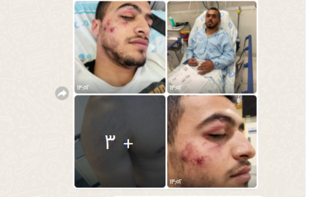 الشرطة الاسرائيلية : الاعتداء على قاصرين من برطعه