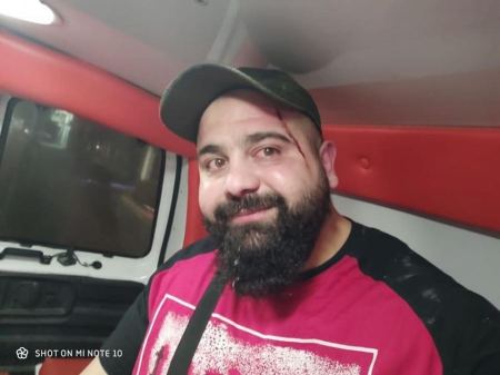 الاعتداء على شابين من الطيرة في مدينة القدس واصابتهما بجراح