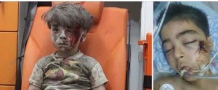 نجا عمران ومات أخوه.. وفاة شقيق طفل حلب الذي صدمت صوره العالم