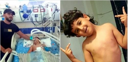 يجئال سلوفيك يطمئن على حالة الطفل أيهم عبد الهادي من أم الفحم 