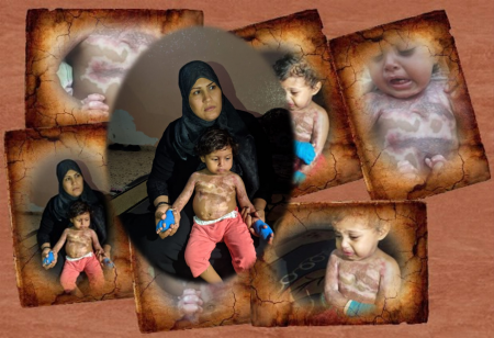  انقذوا حياة الطفلة ميرا